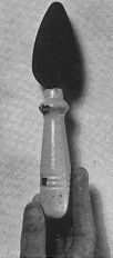 A wood-handled carborundum sharpening stone extracted from the rectum.